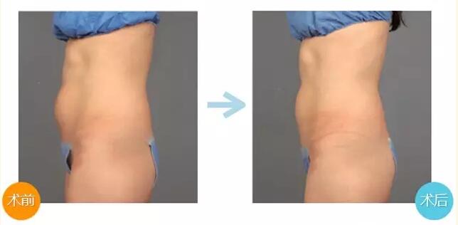 �w��x��&ldquo;��(y��u)����&rdquo;����