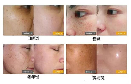 ���}Ƥ�w�K�Y(ji��)��&mdash;&mdash;��Ƥ�뼤��1064QVYH