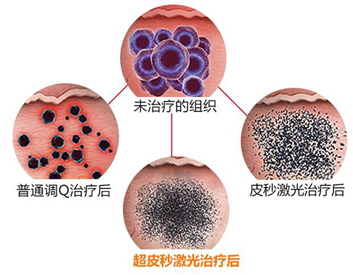 ���}Ƥ�w�K�Y(ji��)��&mdash;&mdash;��Ƥ�뼤��1064QVYH