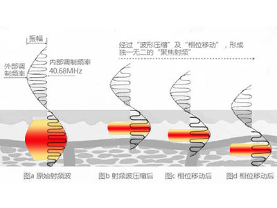 ������LTV-FD+���מ�ʲô�@ô��